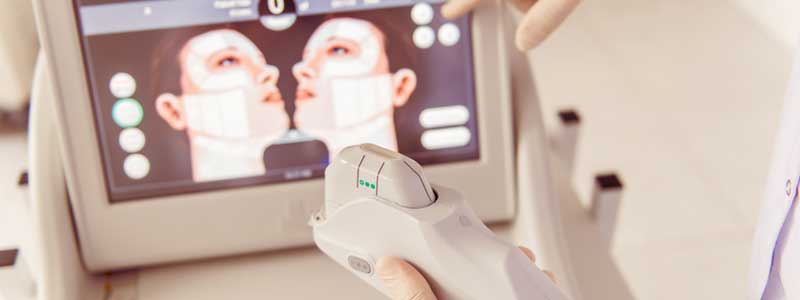 HIFU-Facelifting - Die sanfte Alternative