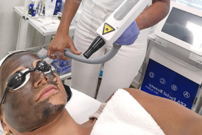 Carbon Laser Carbon Laser